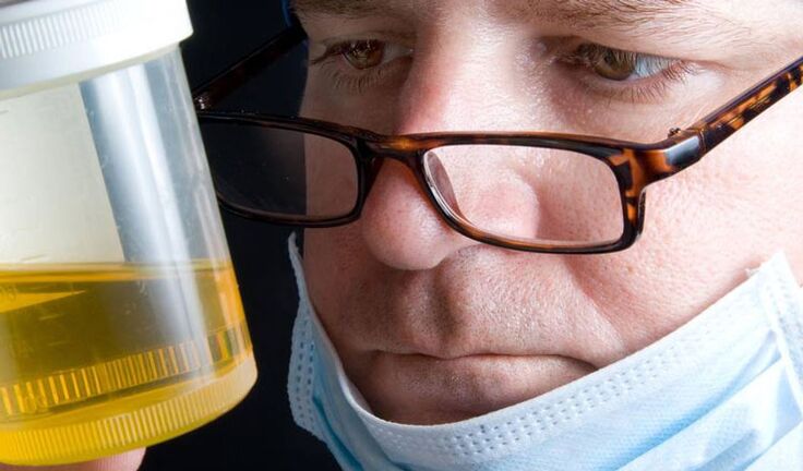 kroonilise prostatiidi uriinianalüüs